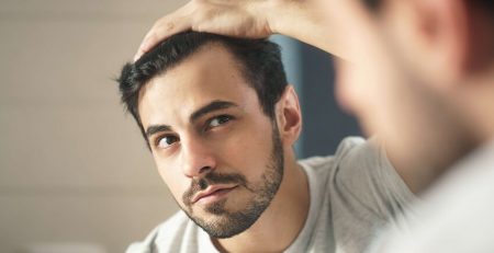 Hair Transplant in Delhi