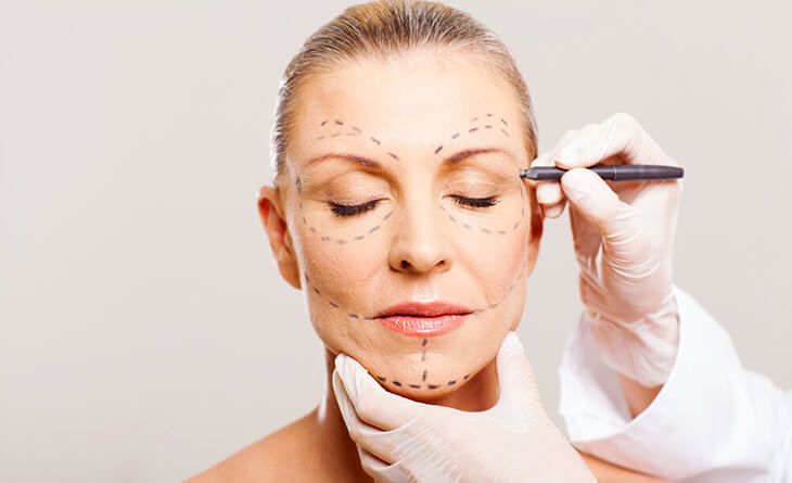 Brow Lift Surgery in Delhi