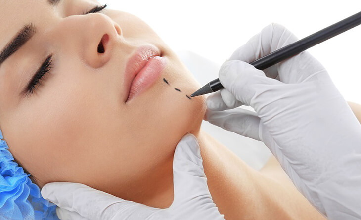 Chin Augmentation Surgery in Delhi