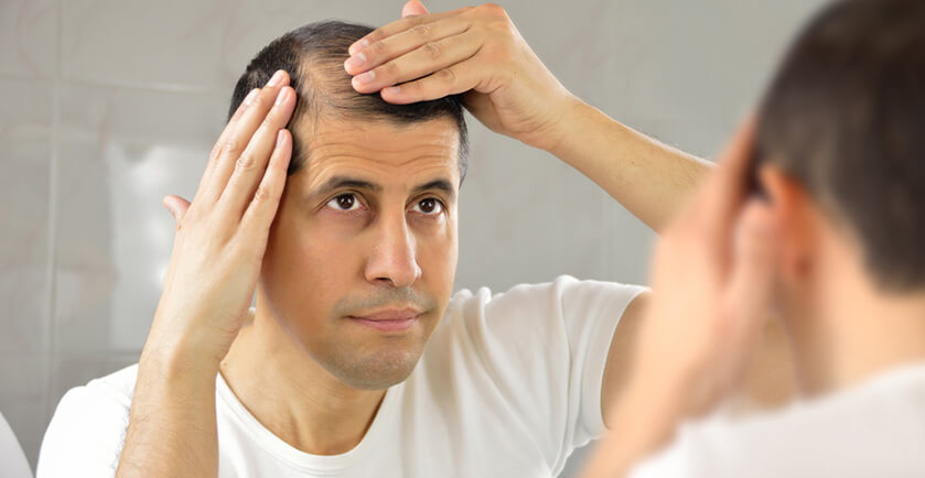 Hair Transplant in Delhi