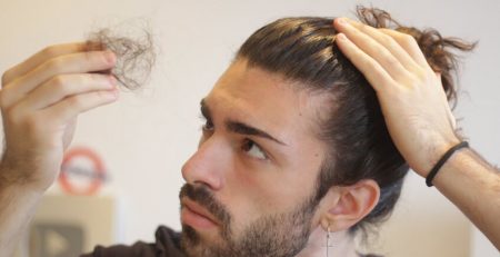 hair transplant in delhi