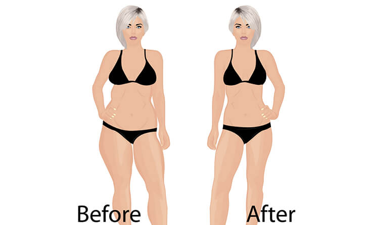 Is Liposuction Surgery Dangerous?