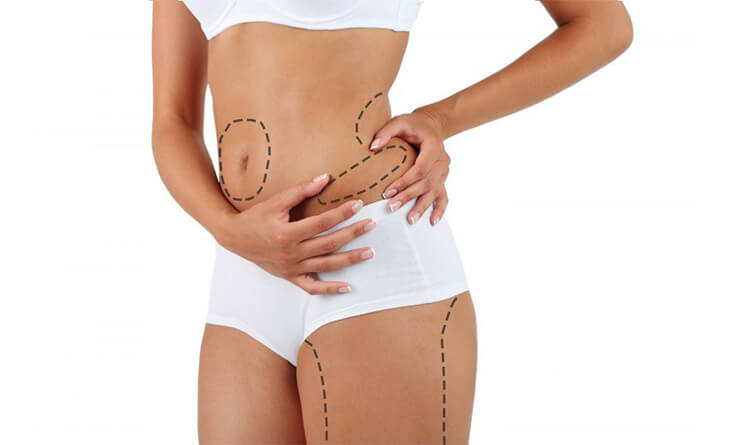 Is Liposuction Surgery Dangerous?