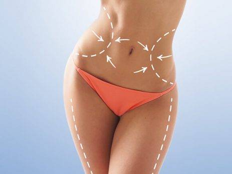 Liposuction Surgery in Delhi