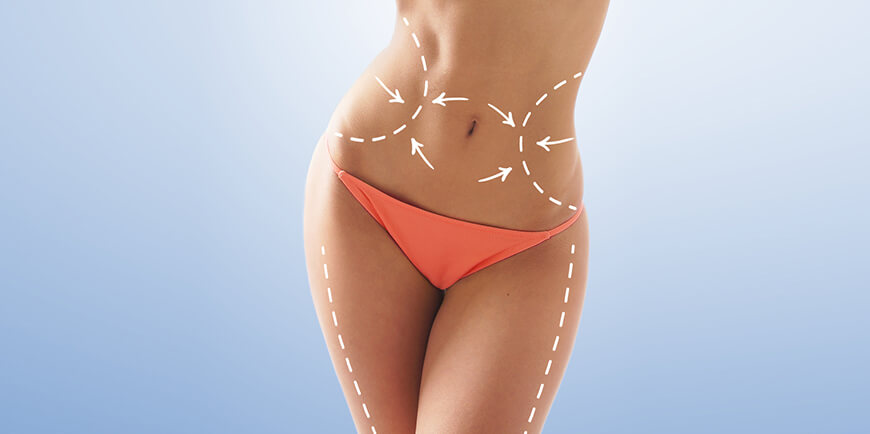 Liposuction Surgery in Delhi