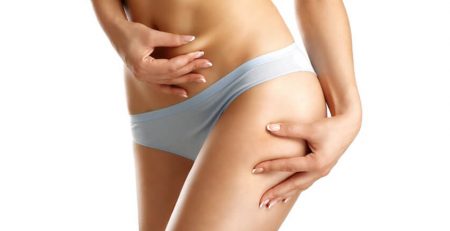 Liposuction Surgery in Delhi