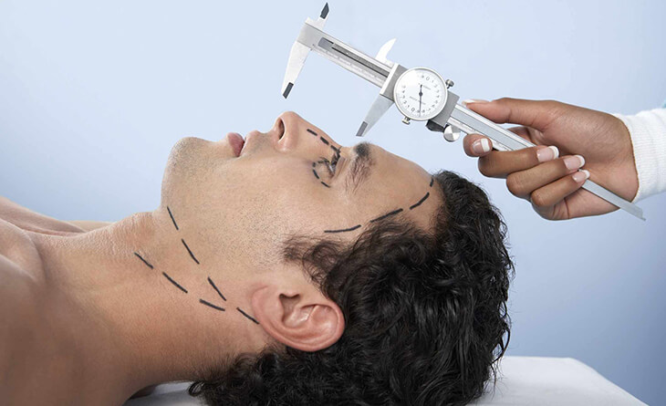 Rhinoplasty in Delhi