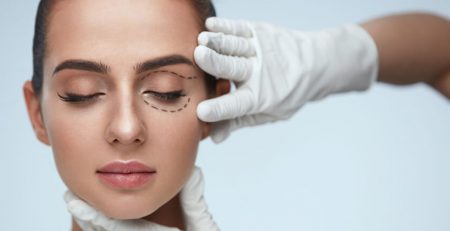 Blepharoplasty surgery