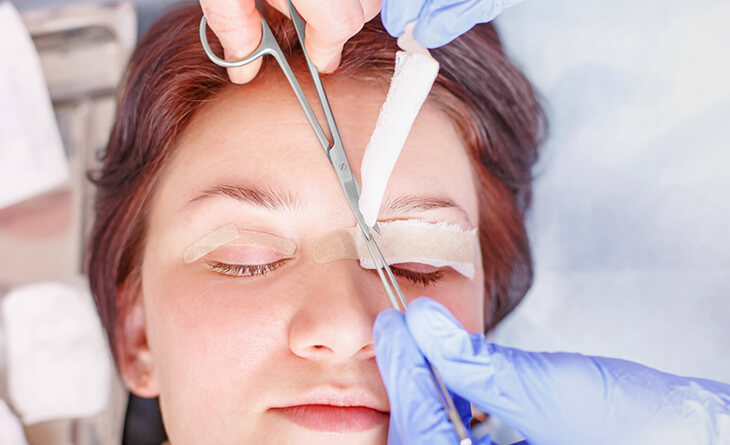 Blepharoplasty Surgery in Delhi