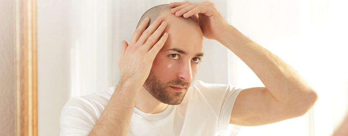 Hair Transplant Recovery time - Dr Lokesh Handa - Best Plastic Surgeon in Delhi -011