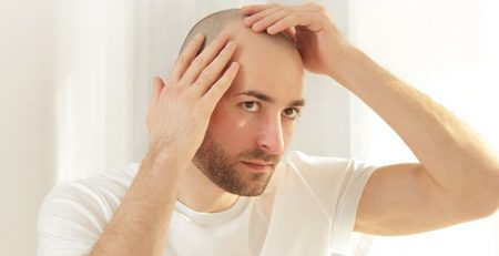 Hair Transplant Recovery time - Dr Lokesh Handa - Best Plastic Surgeon in Delhi -011