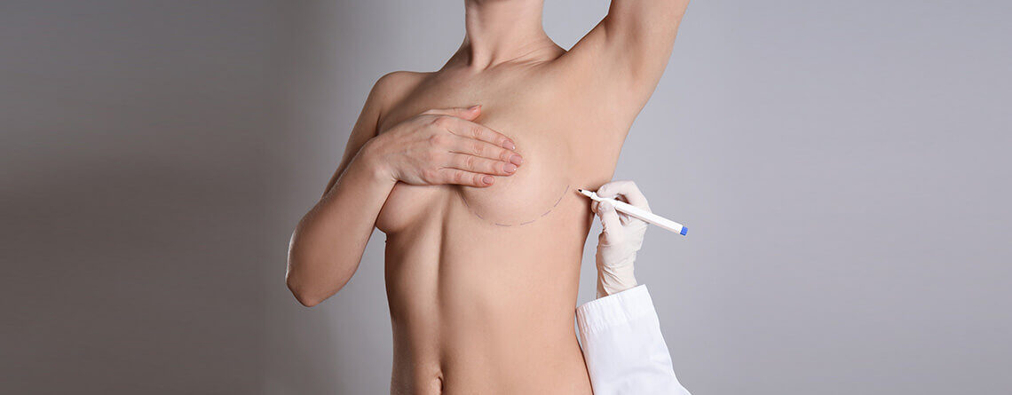 Breast Lift surgery in Delhi