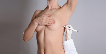 Breast Lift surgery in Delhi