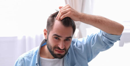 Hair transplant surgery in Delhi