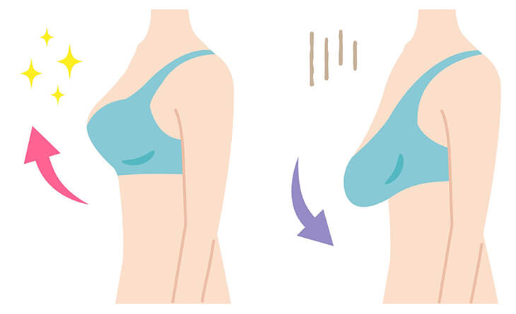 What Are the Benefits of a Breast Lift? - Dr. Kadz