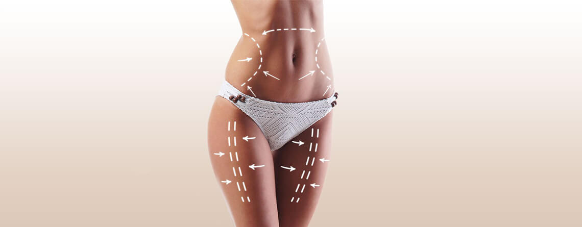 Liposuction Surgery in Delhi