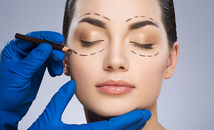 Blepharoplasty surgery in Delhi