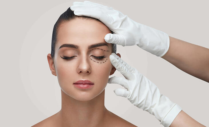 Blepharoplasty Surgery in Delhi