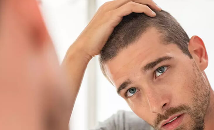 Hair Transplant in Delhi