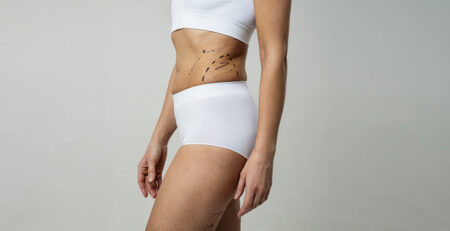 Liposuction surgery cost