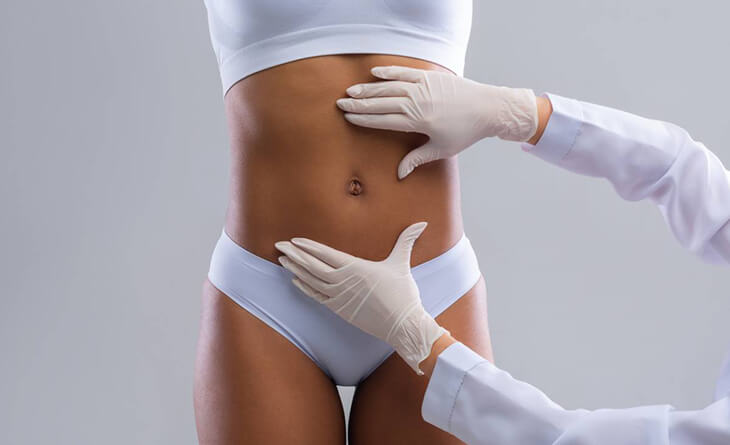 Liposuction surgery