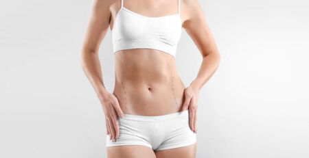 Liposuction surgery