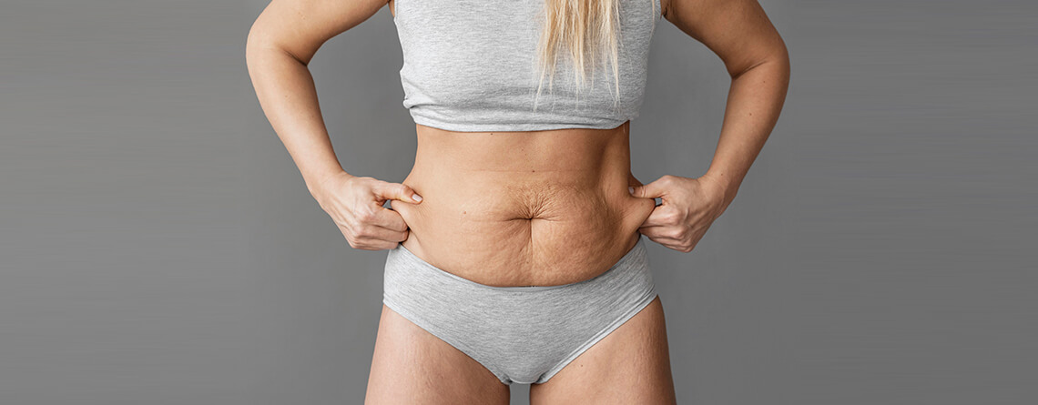 Tummy tuck surgery