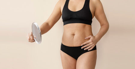 Tummy tuck surgery