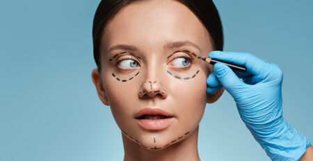 eyelid surgery