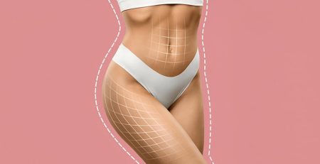 liposuction surgery