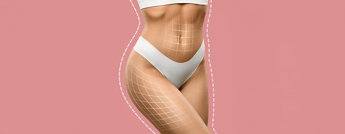 liposuction surgery