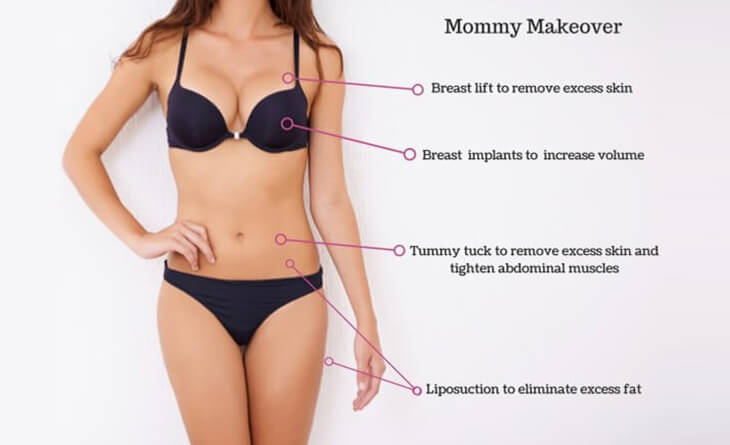 liposuction surgery