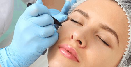 eyelid surgery