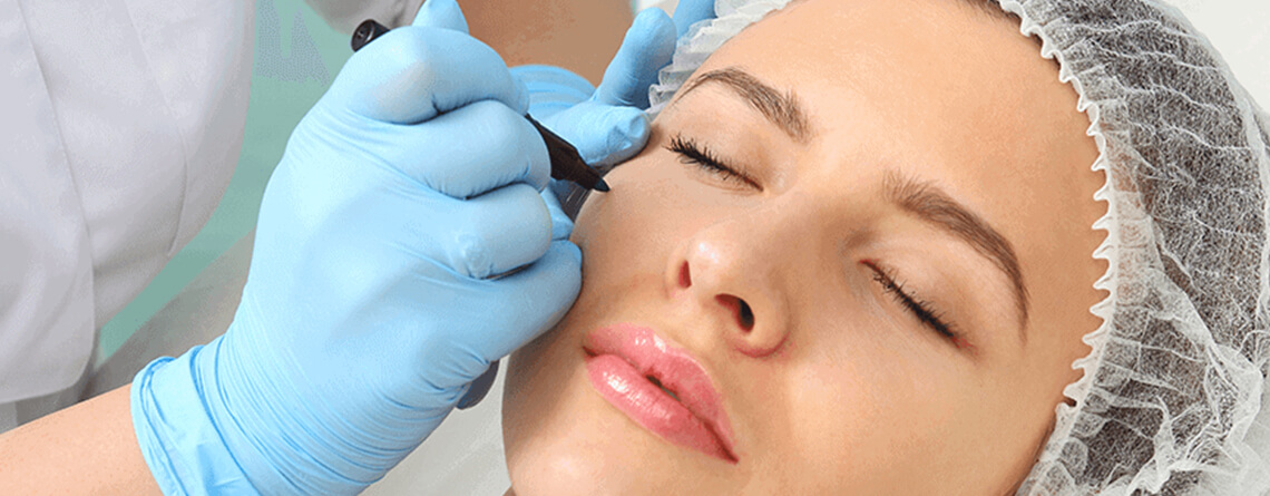 eyelid surgery