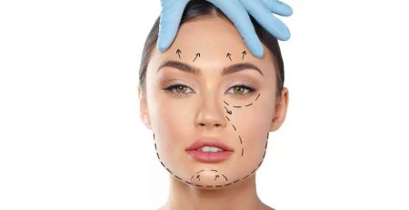 facelift surgery