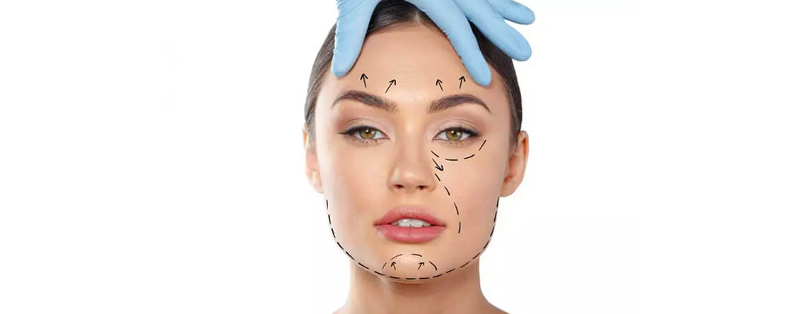 facelift surgery