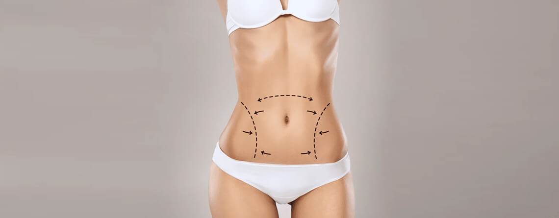 tummy tuck surgery