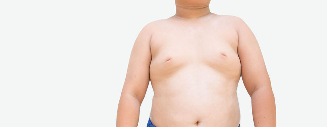 gynecomastia surgery