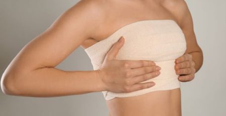 breast reduction surgery