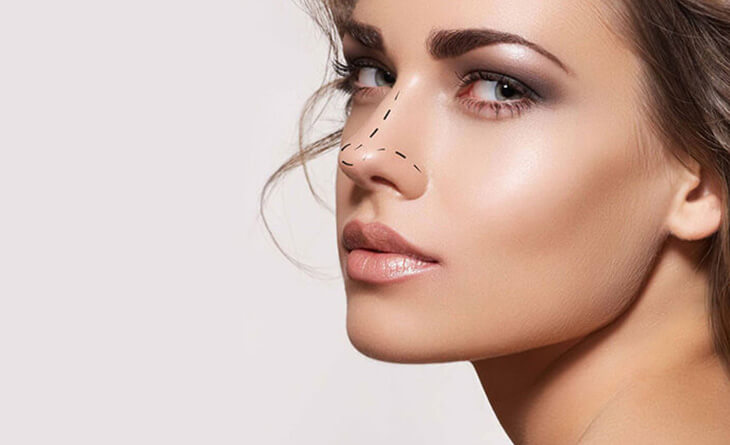 How Long After Rhinoplasty Can I Wear Glasses - Rhinoplasty surgery - Dr Lokesh Handa - Med Esthetiks -03 rhinoplasty surgery in delhi