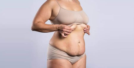 tummy tuck surgery in delhi