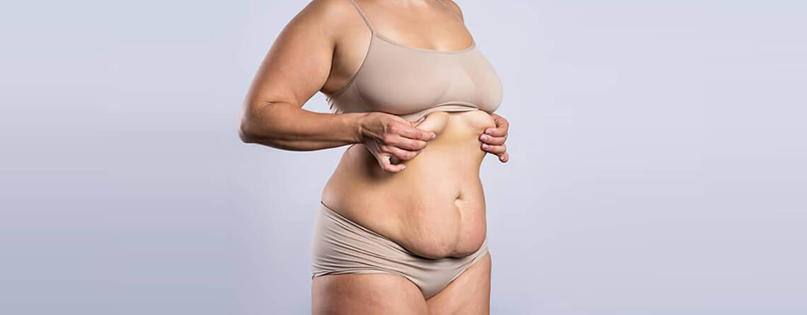 tummy tuck surgery in delhi