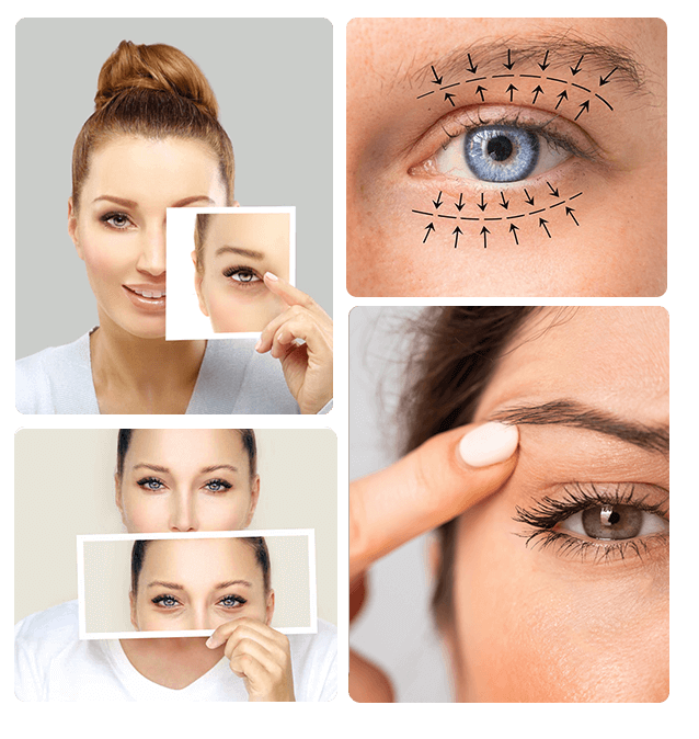 Types of Eyelid Surgery We Offer - Med Esthetiks Types of Eyelid Surgery We Offer - Med Esthetiks