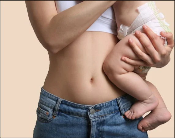 Med Esthetiks_Benefits of Mommy Makeover_20
