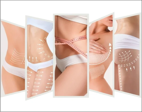 Med Esthetiks_Types of Body Lift Procedures_13