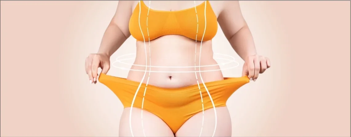 Types of Tummy Tucks