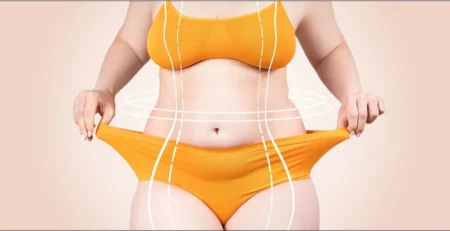 Types of Tummy Tucks