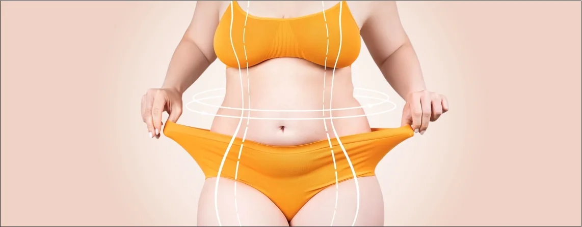 Types of Tummy Tucks