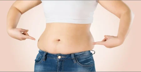 Stubborn Fat Removal