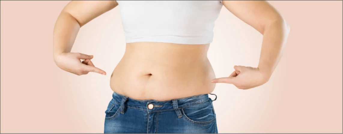 Stubborn Fat Removal